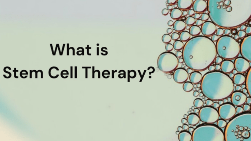 Stem Cell Therapy: Transforming Medicine for the Future