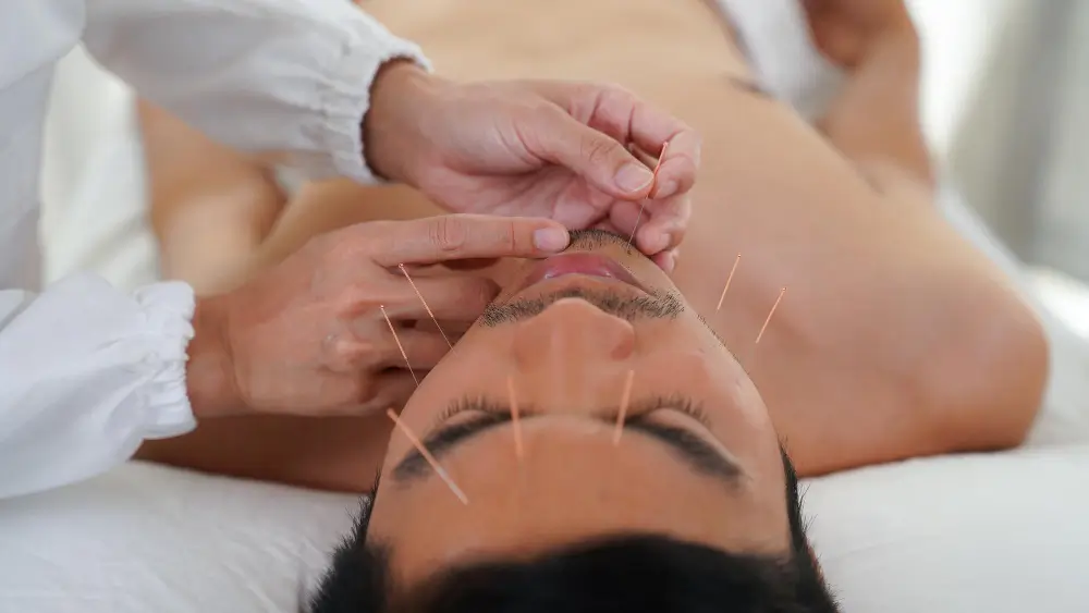 benefits of acupuncture 