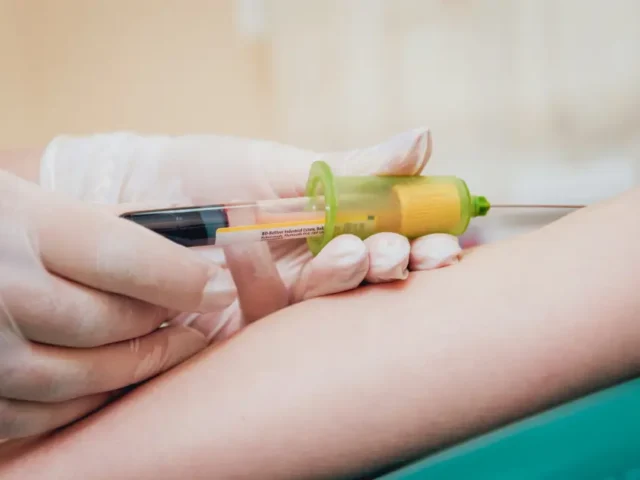IV Chelation Therapy in NYC: Breaking Down the Benefits, Side Effects, and Cost