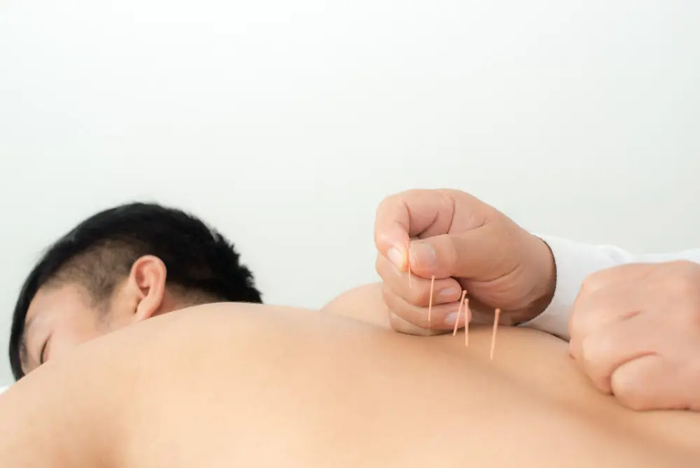 Acupuncture Treatment in NYC 