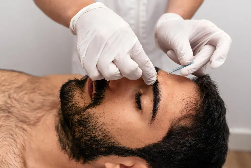 benefits of acupuncture 