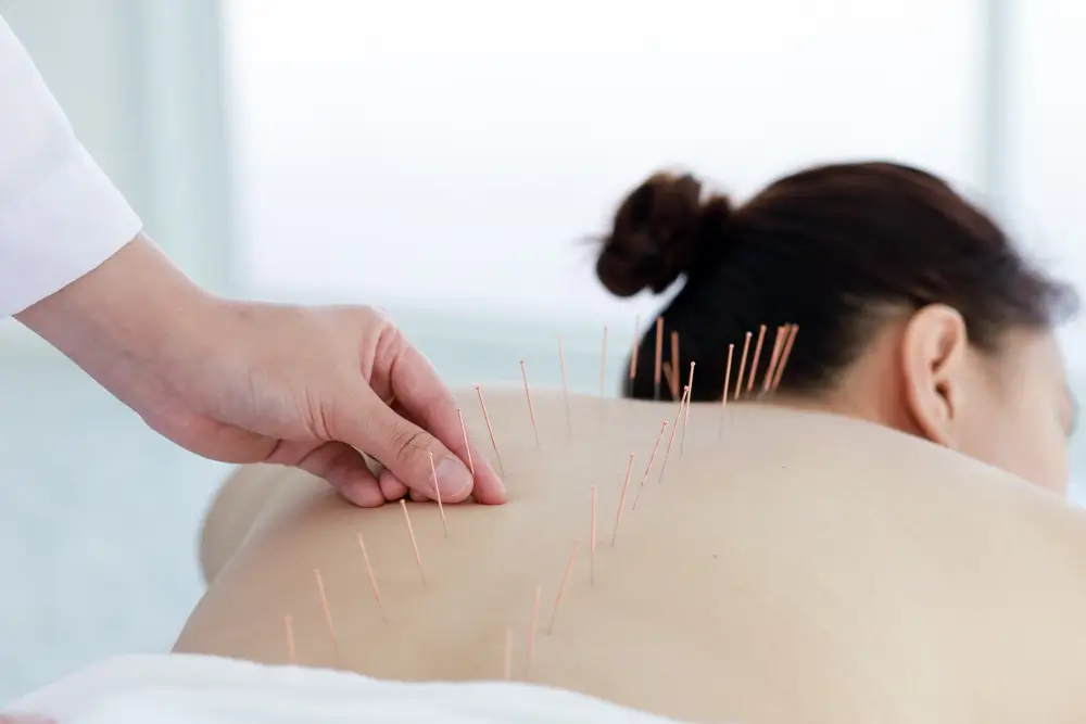 acupuncture treatment near me