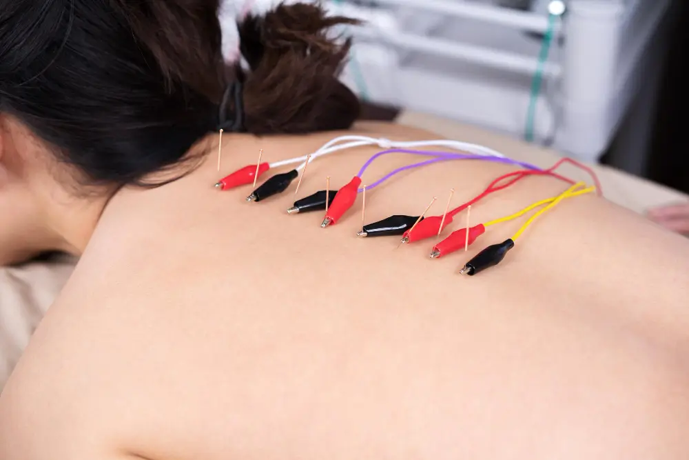 Acupuncture Treatment In NYC