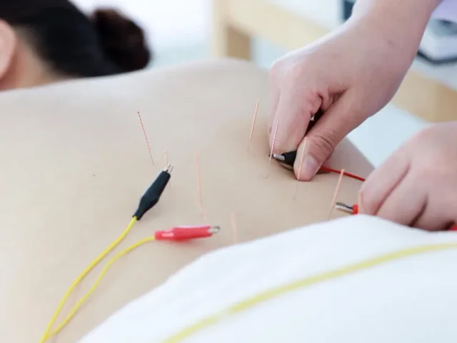 Is acupuncture right for you? What to expect at your first session