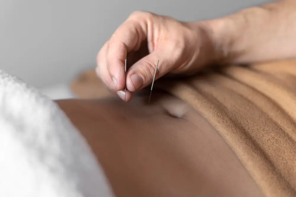 Acupuncture Treatment in NYC