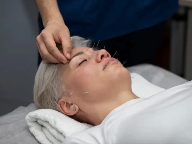 Say Goodbye to Chronic Pain – Acupuncture’s Role in Long-Term Relief