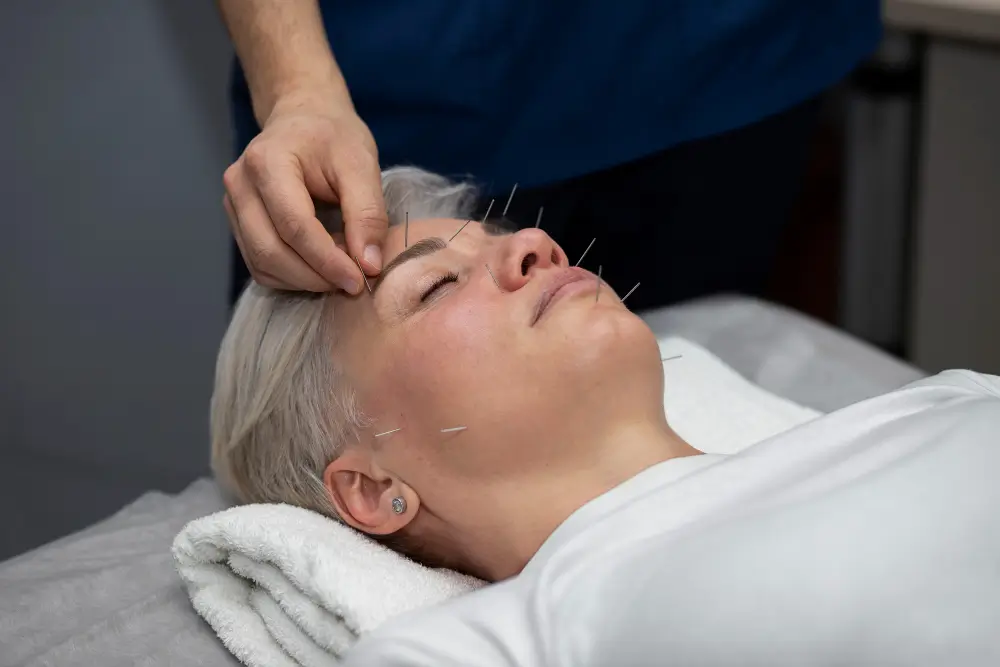 Acupuncture Treatments