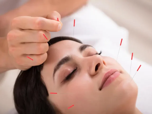 Boost your fertility naturally with acupuncture – what the research says