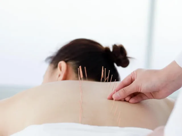 Acupuncture and Integrative Medicine – A Powerful Partnership for Healing