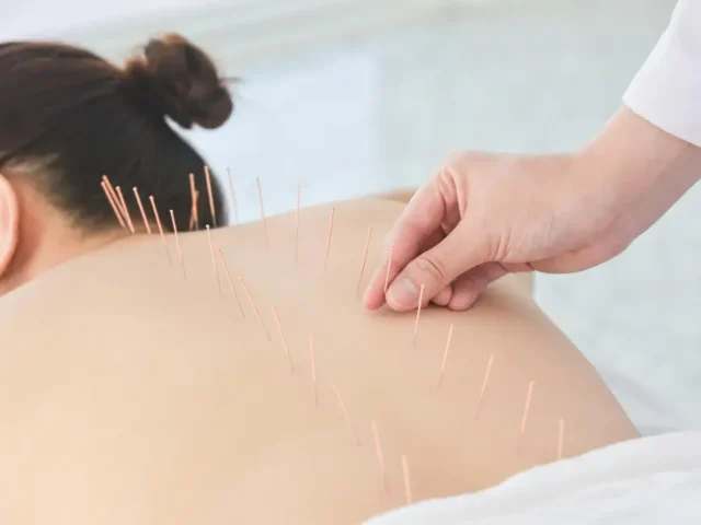 Ancient healing, modern relief – the science behind acupuncture
