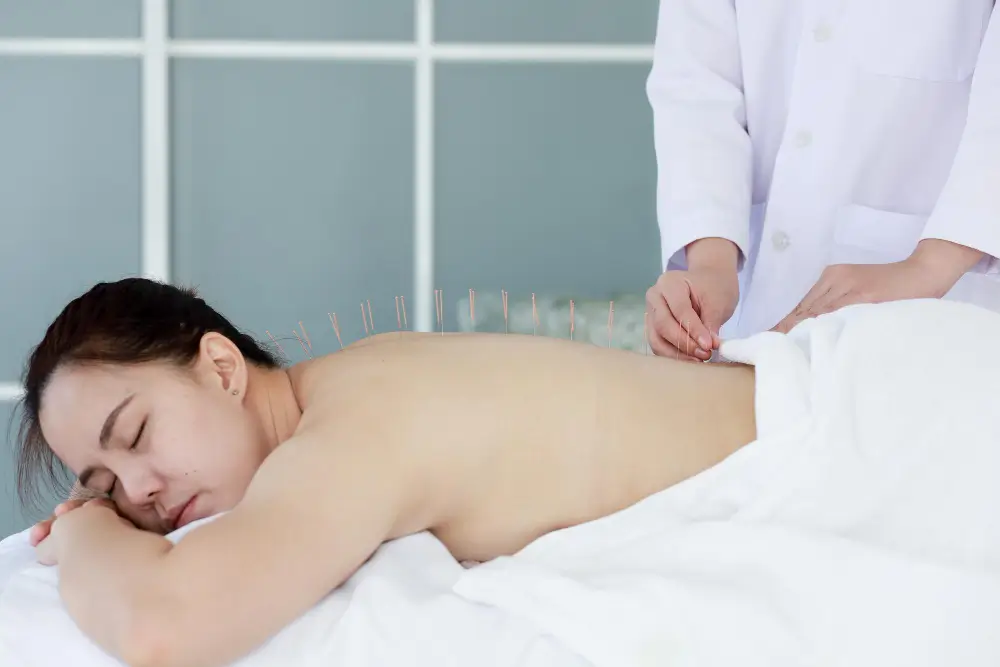 Acupuncture Treatment in NYC