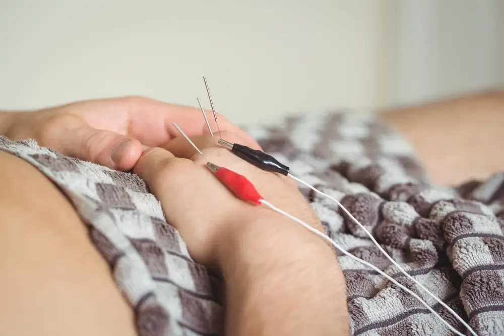 Acupuncture Treatment In NYC