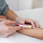 chelation therapy near me