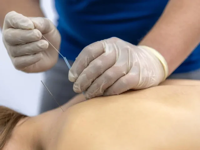 How Acupuncture Can Help with Allergy Symptoms