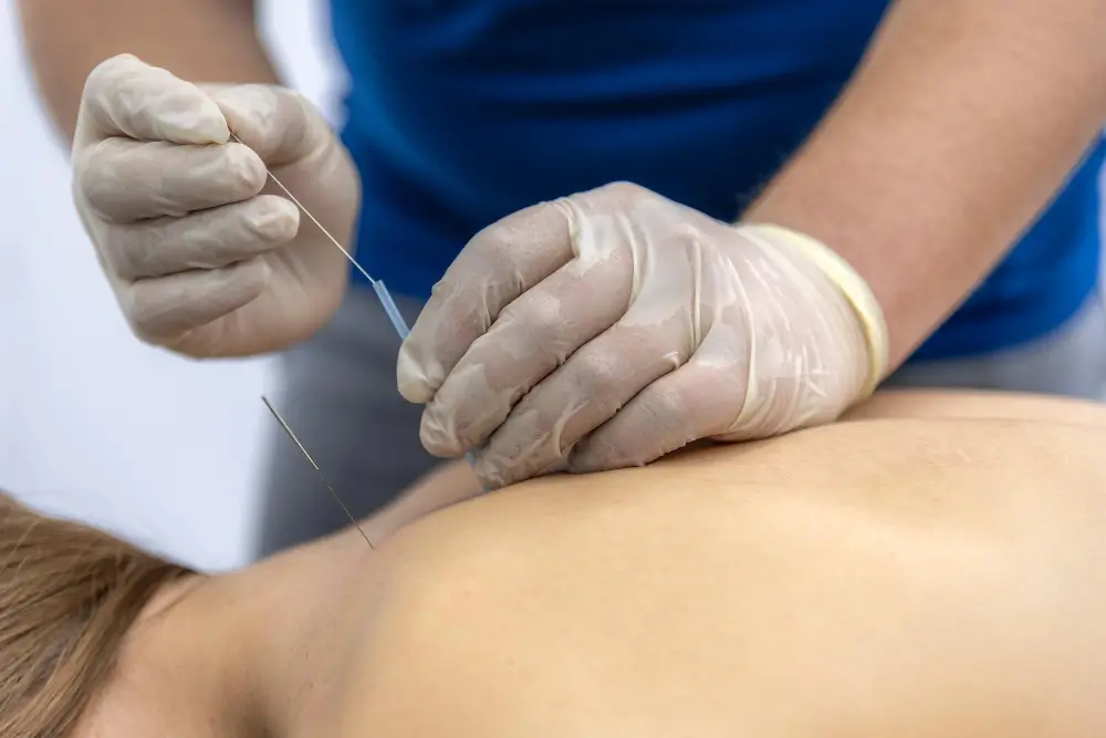 Acupuncture Can Help with Allergy Symptoms