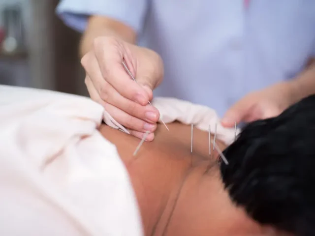 Acupuncture for Cervical Dizziness Relief