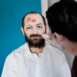 Herpes Symptoms Explained