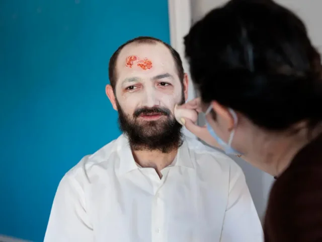 Herpes Symptoms Explained: Early Signs You Should Never Ignore