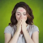 How Stress Impacts Allergic Reactions