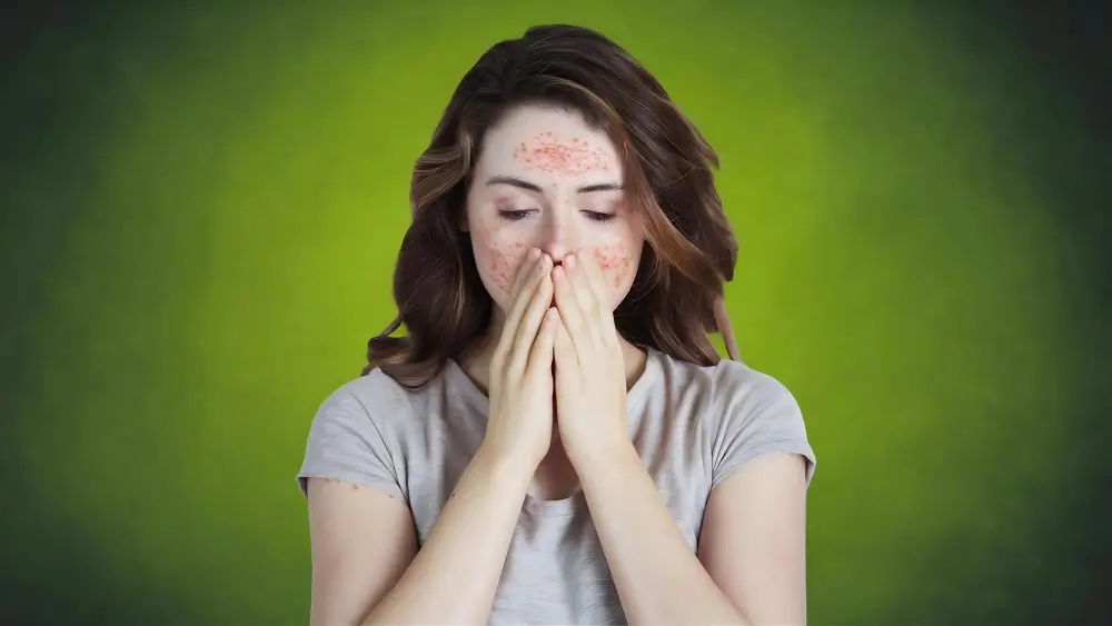 How Stress Impacts Allergic Reactions