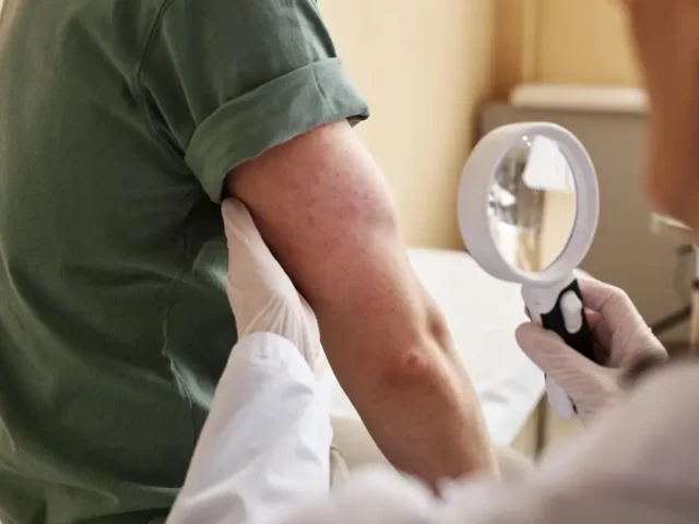 Natural and Holistic Approaches to Chronic Lyme Recovery