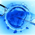 ivf