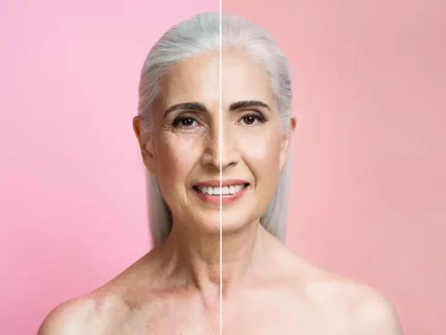 Botox vs Aging: How Injectable Treatments Restore Youthful Skin