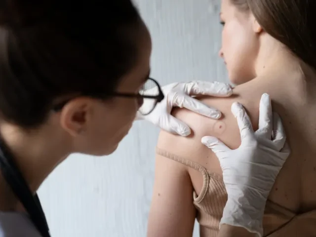 Chronic Lyme Disease vs Acute Lyme: What’s the Difference?