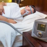 sleep apnea