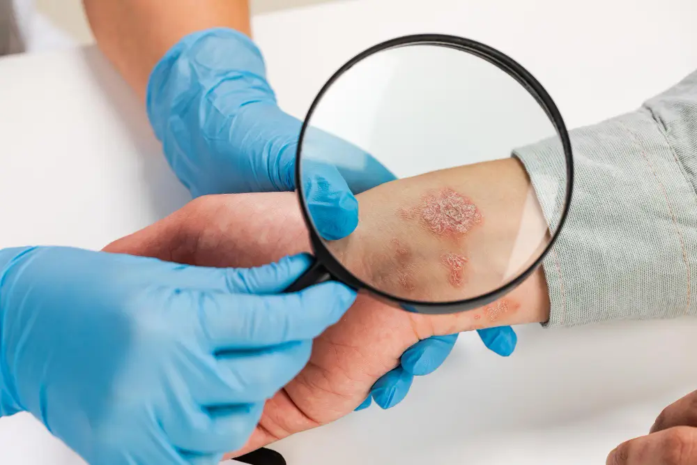 Understanding Lyme Disease Co-Infections: Babesia, Bartonella & More