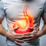Stomach Ulcer